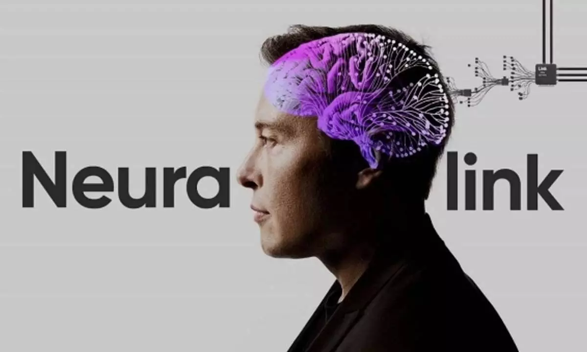 Elon Musk’s Neuralink gets nod to test brain implants