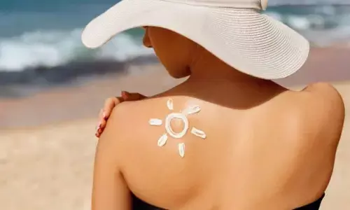 Representational image