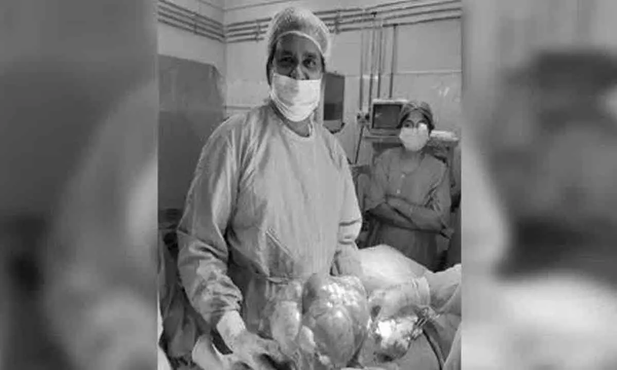 Hyderabad: Osmania General Hospital surgeons remove 7kg Ovarian Cyst successfully