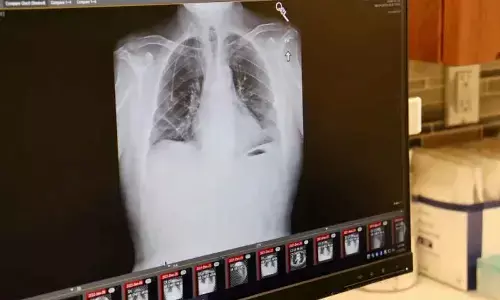 New lung cancer pill cuts risk of death by half