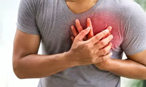 Representational image