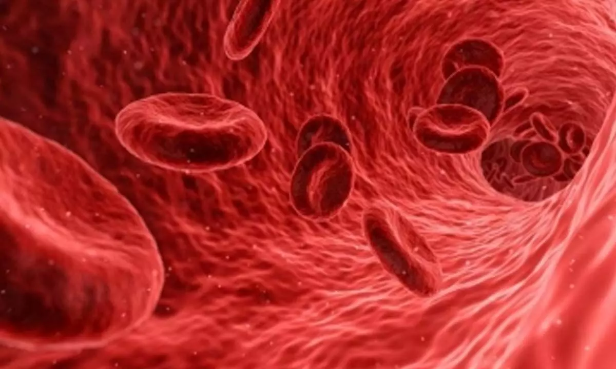 How a national mission can help India tackle sickle cell disease