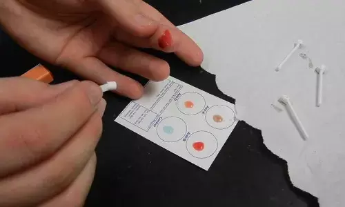 Why type A blood is linked to higher risk of Covid infections