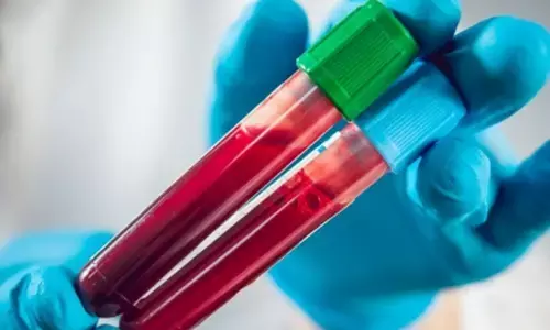 Representational image