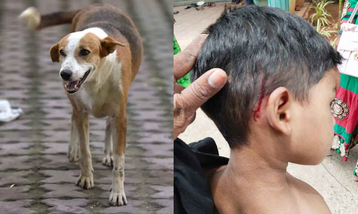 Visakhapatnam Stray dog attacks two children