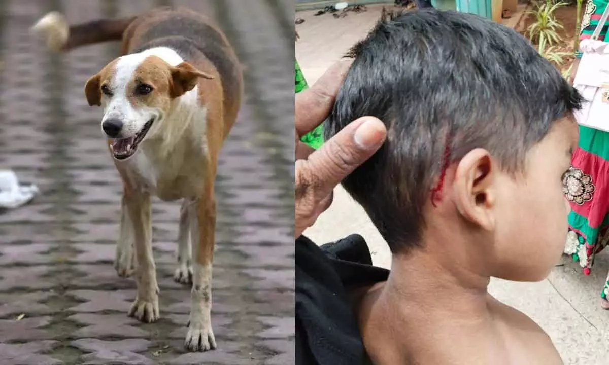 Visakhapatnam: Stray dog attacks two children