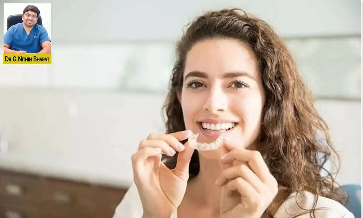 Clear Aligners: Answer to your perfect smile goals