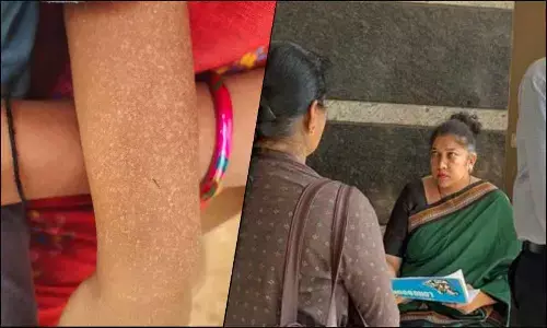 Chamarajanagara villagers affected by strange skin disease