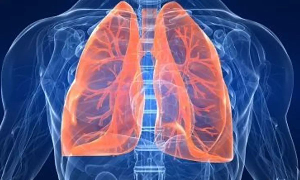 Rising trend of lung cancer cases among women, non-smokers