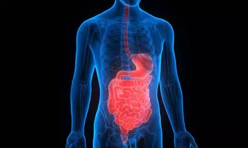Urbanisation driving inflammatory bowel disease in young Indians: Lancet