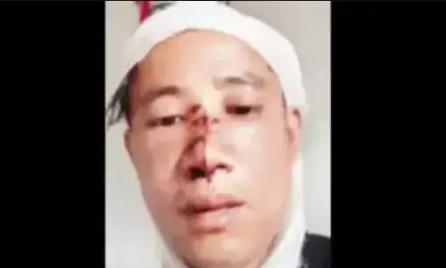 Sikkim man falsely claimed he assaulted by three miscreants: Police