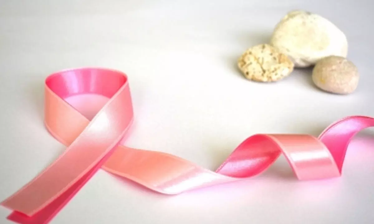 UK researchers develop new model to predict 10-year breast cancer risk