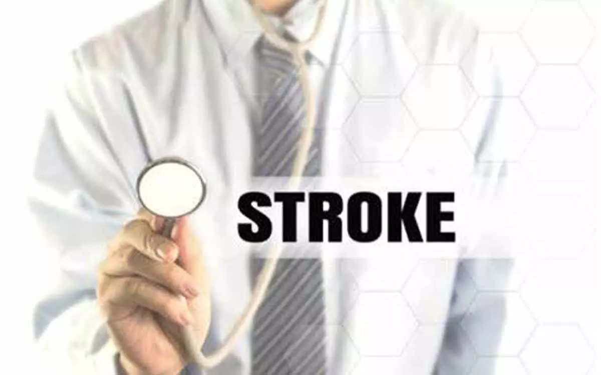 UK researchers develop new tool to reduce stroke risk