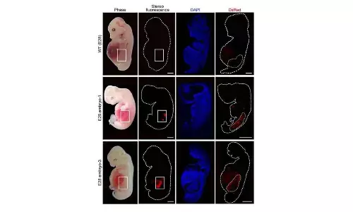 Worlds first human-like kidneys in grown pigs