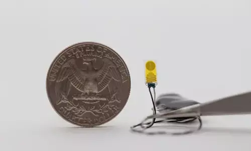 Novel device to monitor transplanted organs for early signs of rejection