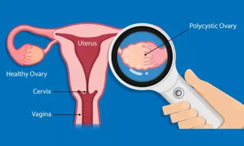 Study shows keto diet boosts fertility among women with PCOS