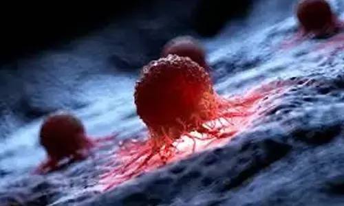 Early-onset cancer causes a mystery