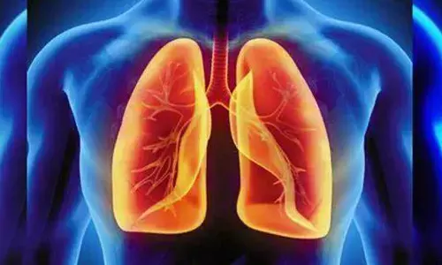 Explained: How lung cells induce immune response to flu