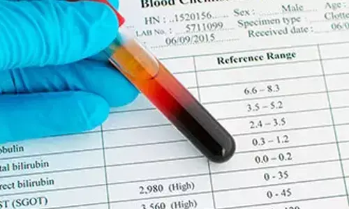 IIT-K signs MoU for manufacture of strip for bilirubin analysis in human blood