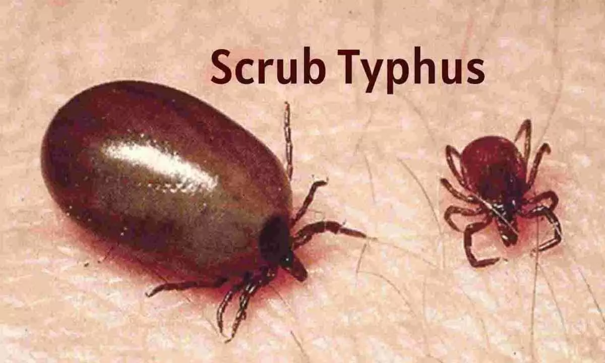 Scrub typhus toll rises to 6 in Odisha