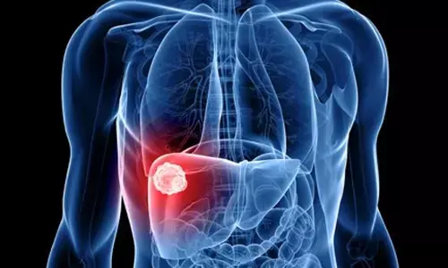 A Game-Changer in Liver Cancer Management: Atezolizumab-Bevacizumab Combination Extends Liver Cancer Patients Survival, Promises New Era in Treatment