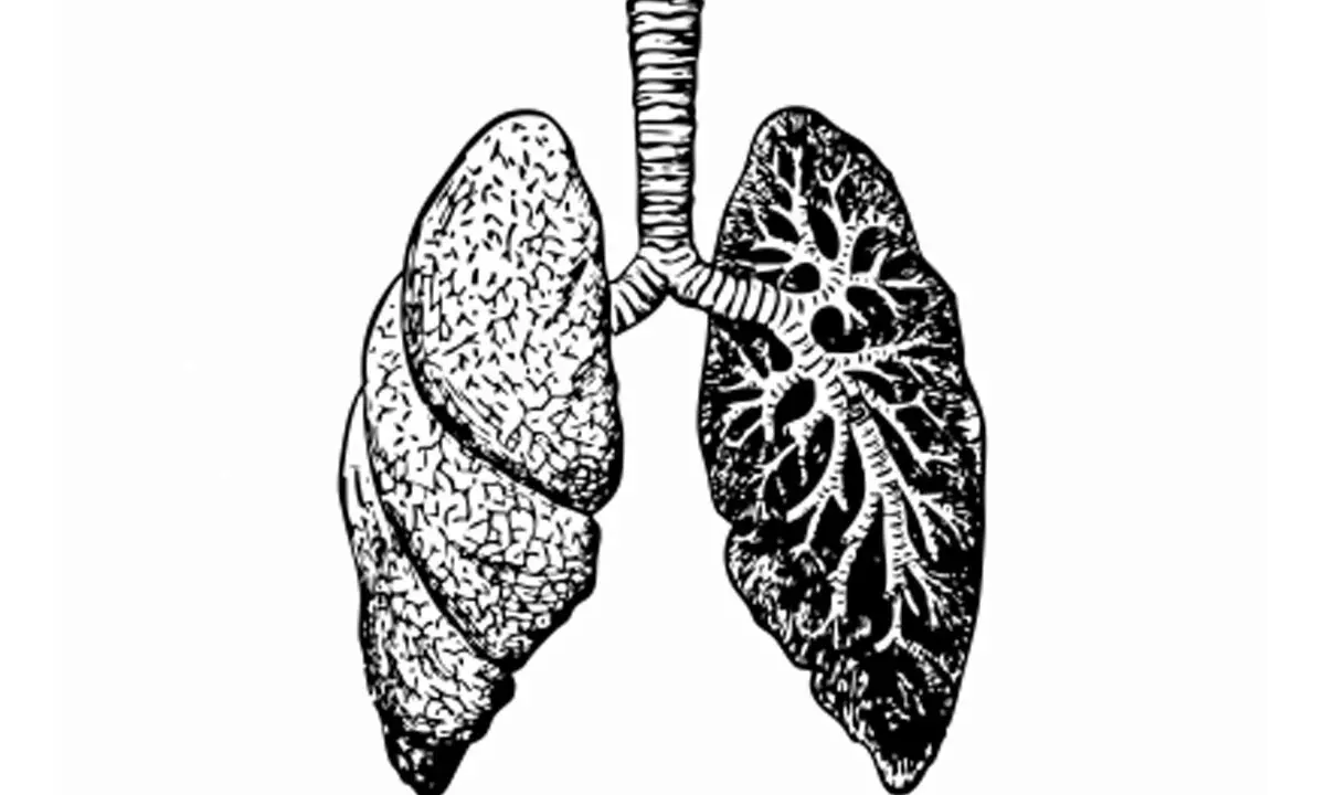 Covid patients continue to suffer from lung complications