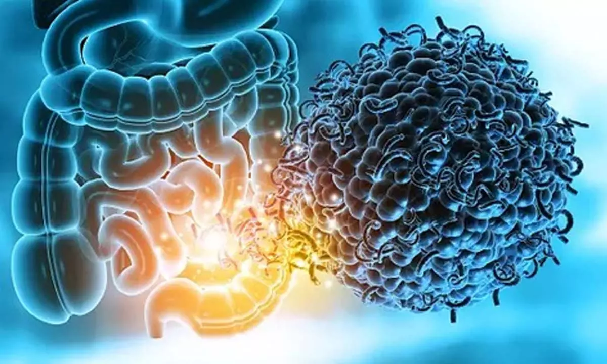 Study shows our gut microbes may determine bone health