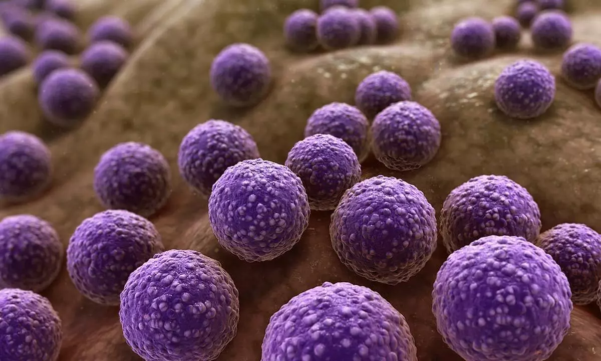 The Silent Epidemic of Antimicrobial Resistance: A Quintuple Whammy