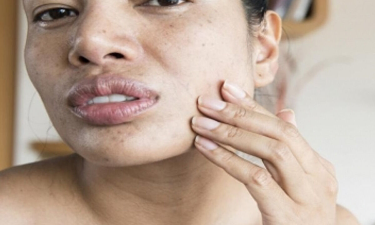 Decoded Why your face feels 'tight' after being washed