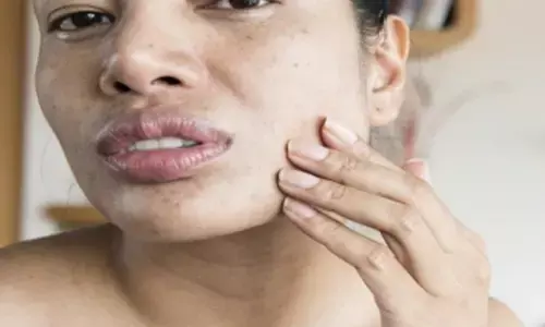 Decoded: Why your face feels tight after being washed