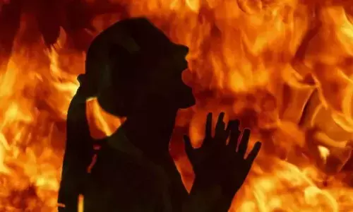 Woman Set On Fire By Family In Uttar Pradesh Over Pregnancy Revelation
