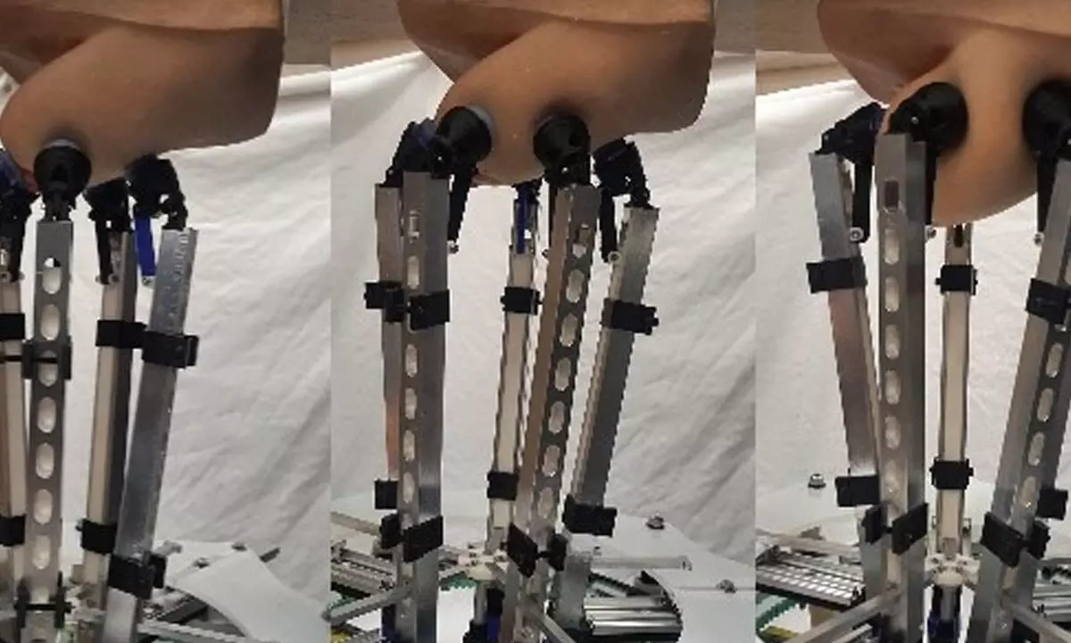 New robot could help diagnose breast cancer early