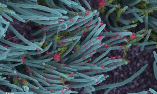 Prior infections, vax determines vulnerability to Covid variants: Study