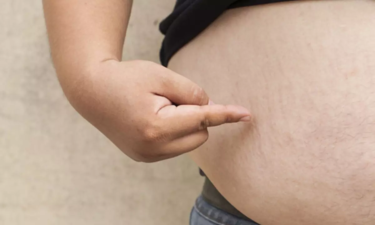 Obesity may up heart disease risk in women than pregnancy complications