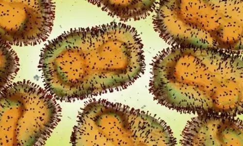 18 out of 20 monkeypox cases in Vietnam test positive for HIV