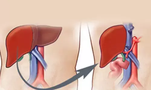 On Dassehra, deceased Mumbai man’s organs give new life to three patients