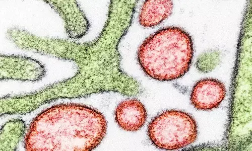 SPECIAL REPORT-Nipah virus outbreak renews calls to protect bat roosts