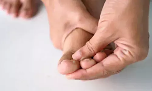 How diabetes can affect health of your skin and feet