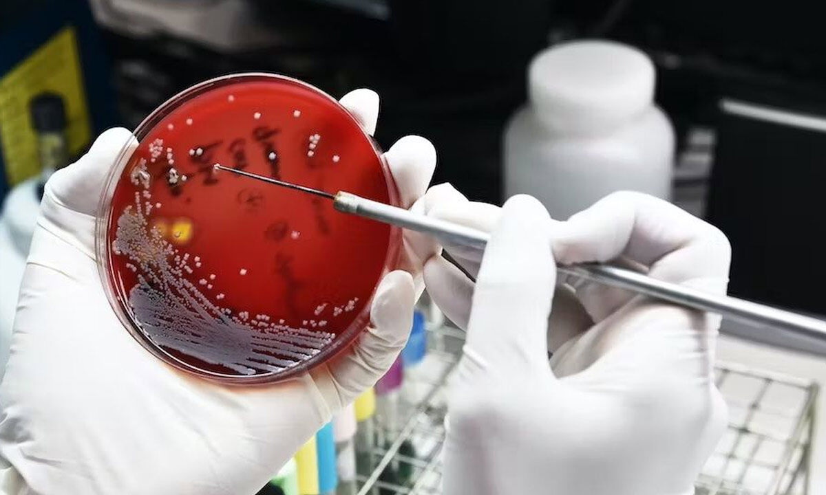 AMR: Scientists turn to new technologies for solutions