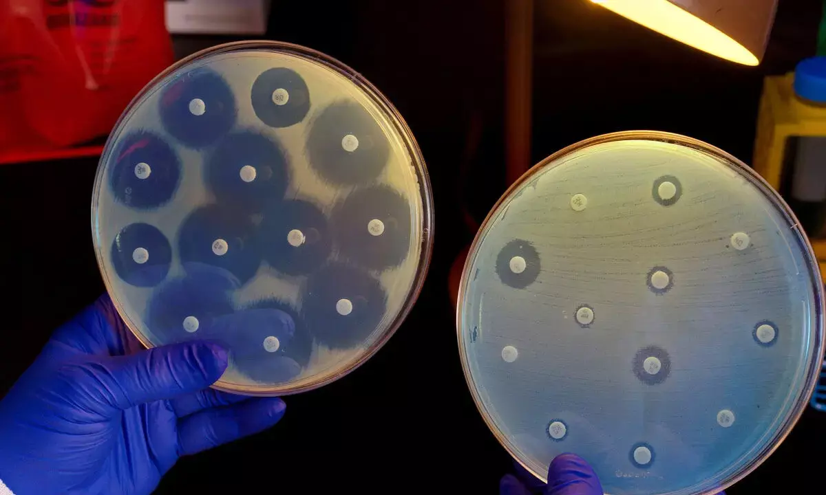 4 ways bacteria resist