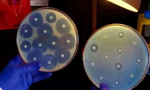 4 ways bacteria resist