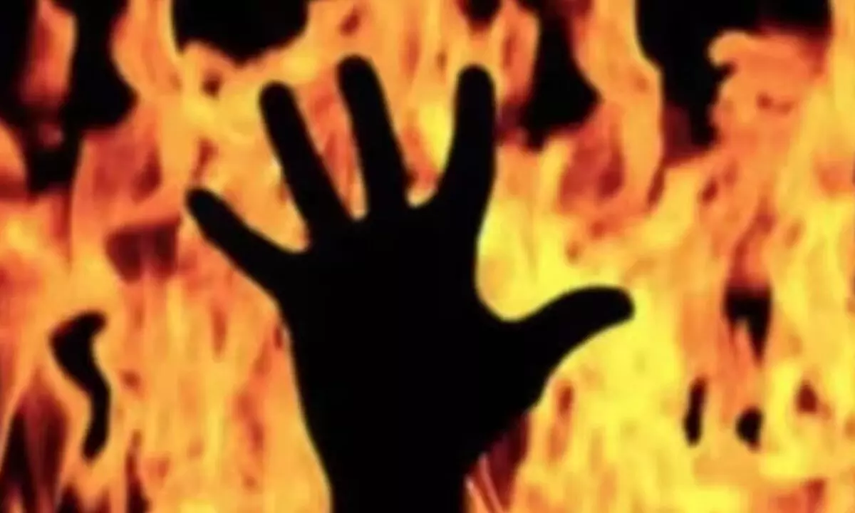 Student Sets Himself On Fire After School Scolding In Karnataka