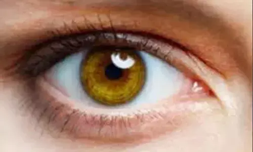 Doctors remove over 60 live worms out of womans eyes in China