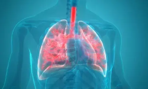 Pneumonia cases hikes in Hyderabad
