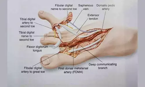 Techie gets a toe for his lost thumb in a fire cracker injury