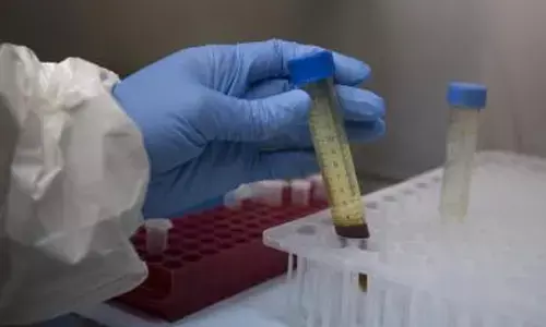 Scientists find new method Ebola virus uses to infect cells