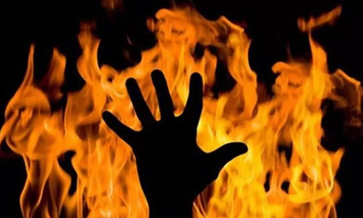 MP barbarity: Woman in Ratlam assaulted, set afire by brother-in-law for revenge