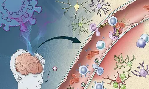 Covid infection can cause months-long brain injury