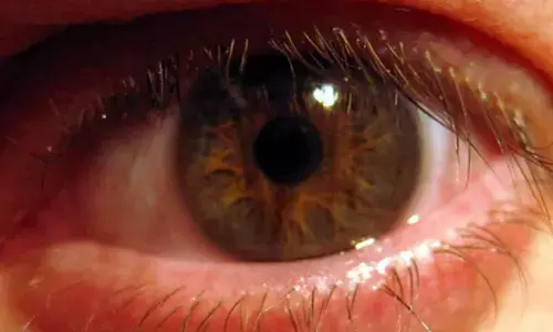 Blood flow changes in eyes may affect visual symptoms of migraines: Study