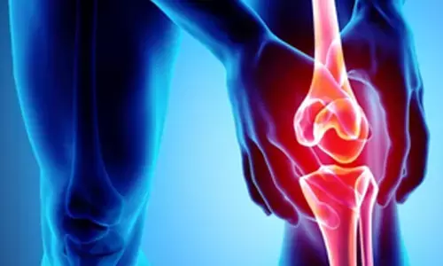 Epilepsy drug may help slow joint degeneration in osteoarthritis
